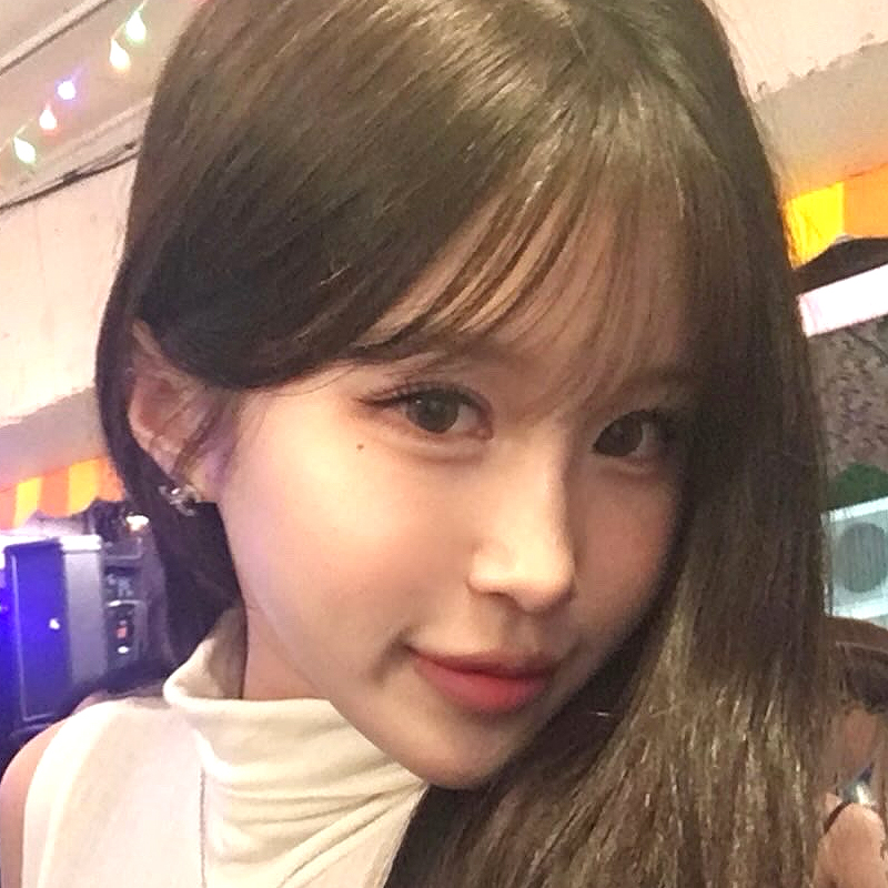 팝성형외과에서 12홀자연유착+윗트임 3개월차 후기입니다~!
