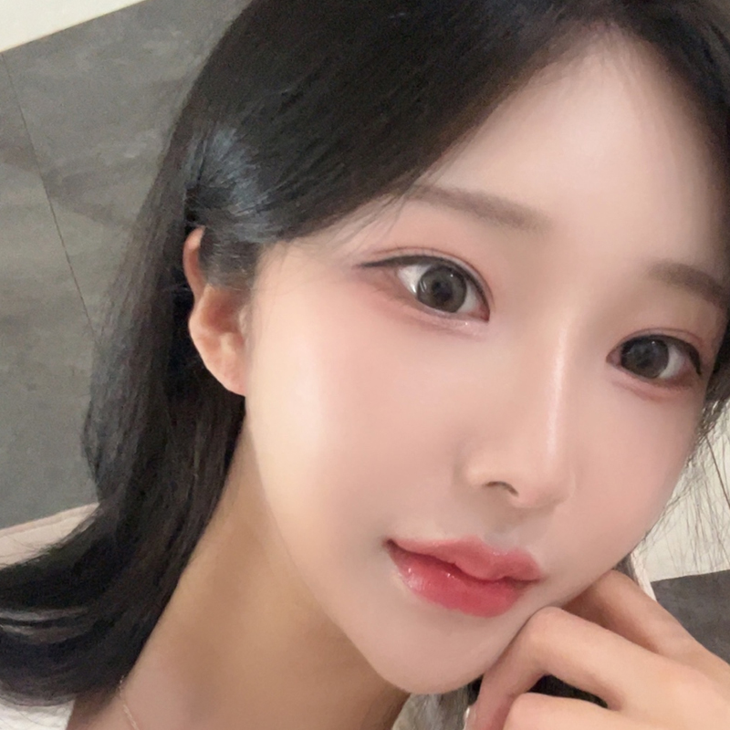 팝성형외과에서 두줄따기+윗트임+뒤밑트임 4개월차 후기