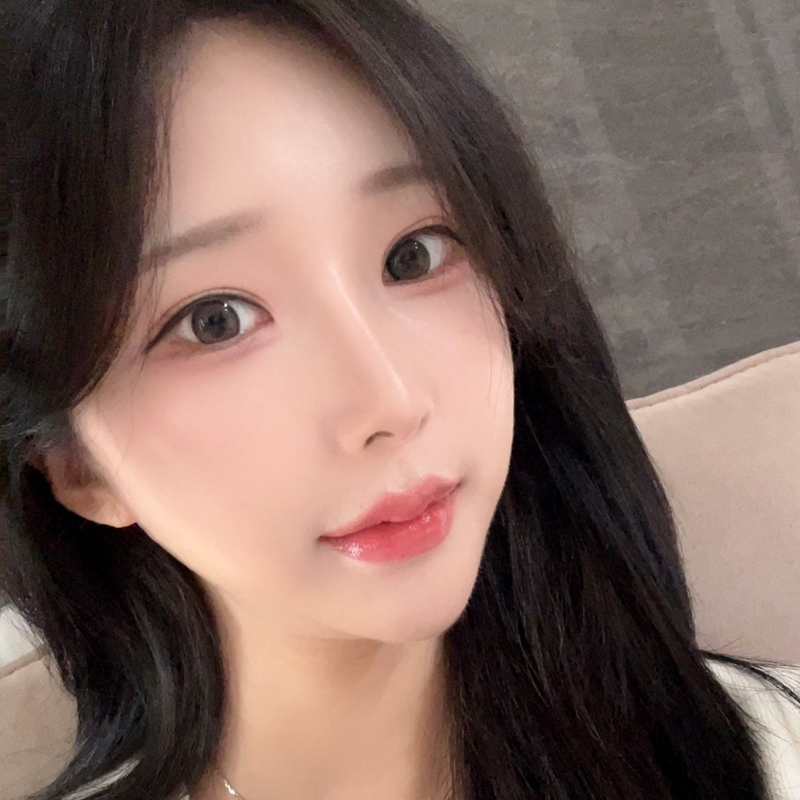 팝성형외과에서 두줄따기+윗트임+뒤밑트임 3개월차 후기입니다!