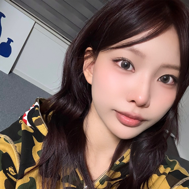 팝성형외과에서 12홀 자연유착+앞트임+윗트임+뒤밑트임 2개월차 후기입니다!