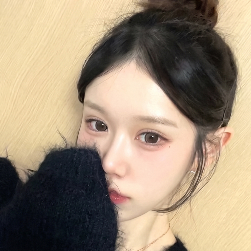 팝성형외과에서 12홀 자연유착+윗트임+뒤밑트임 1개월차 후기입니다:)