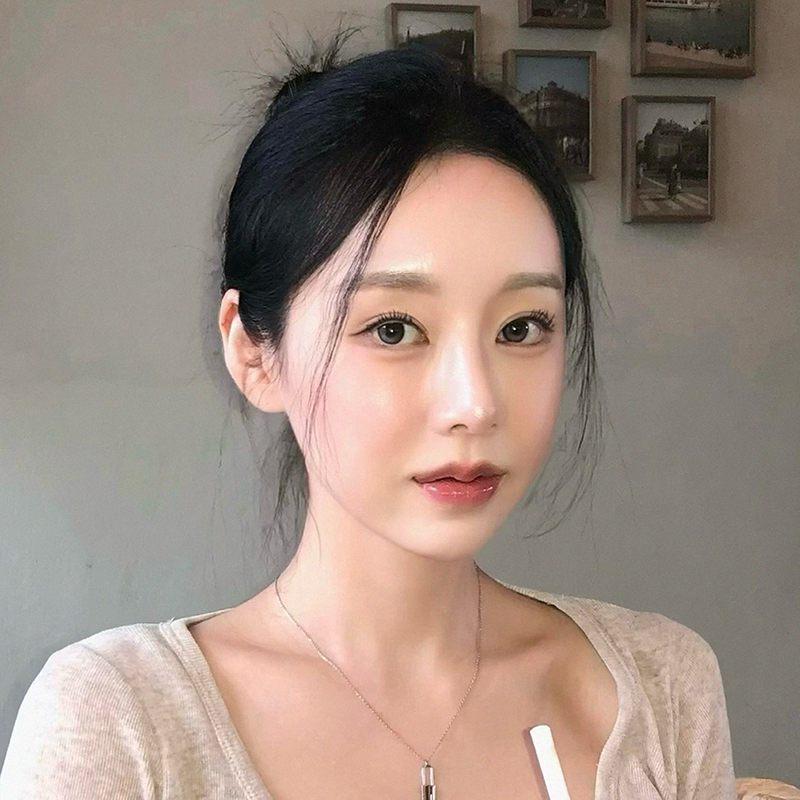 팝성형외과에서 12홀자연유착+뒤밑트임+눈위지방이식 2개월차 후기입니다:)