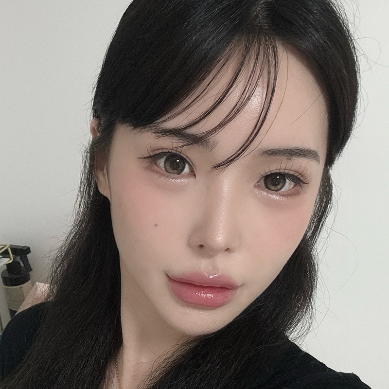 팝성형외과에서 12홀자연유착+뒤밑트임 3개월차 후기입니다!