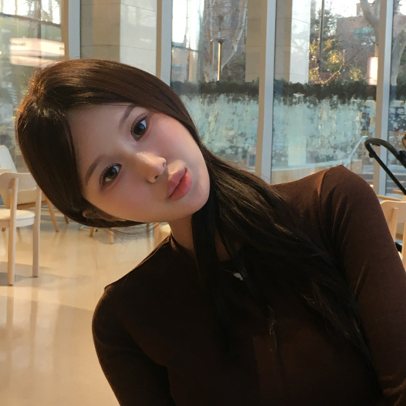 팝성형외과에서 12홀자연유착+윗트임 1개월차 후기입니다:)
