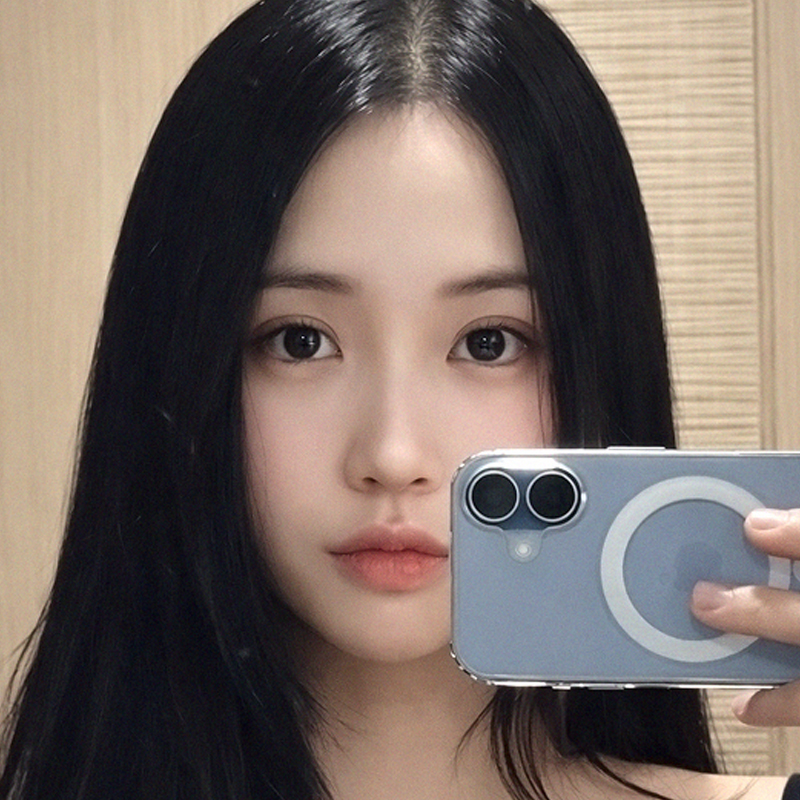 팝성형외과 12홀 자연유착+윗트임+앞트임+뒤트임+밑트임 2주차 후기