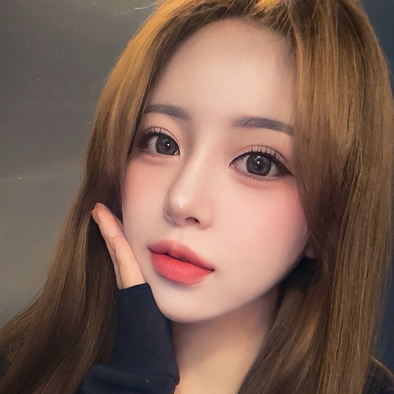 팝성형외과 자연유착 눈밑지방재배치 1달차 후기