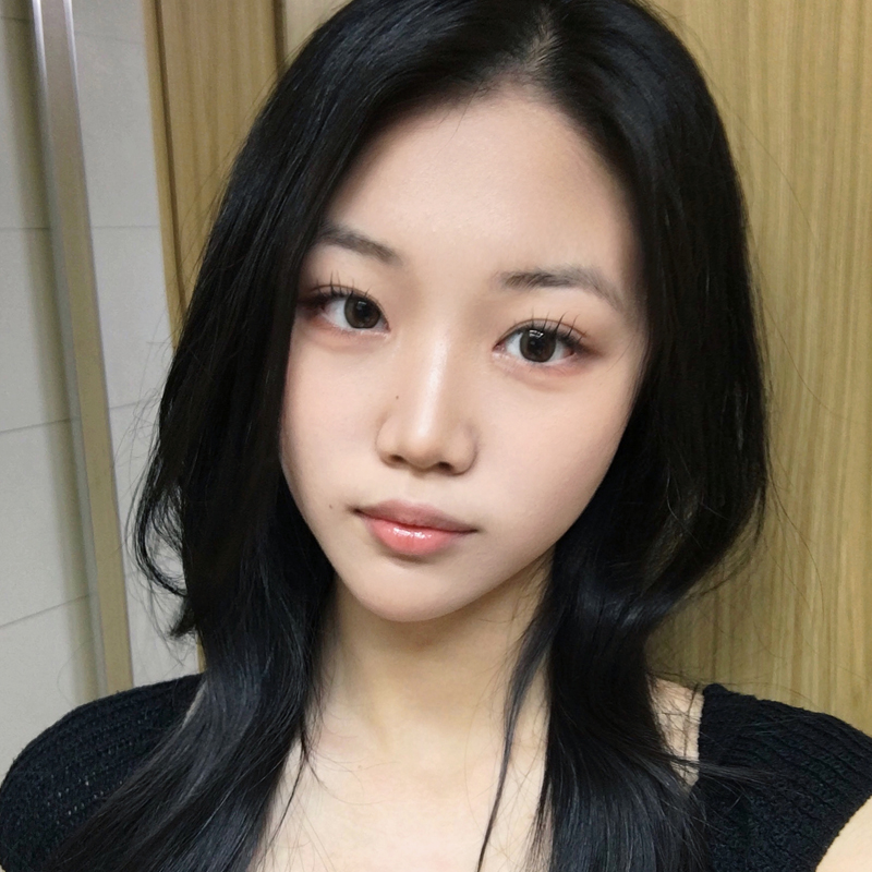 팝성형외과에서 12홀자연유착+눈매교정+앞윗트임 3개월차 후기입니다:)