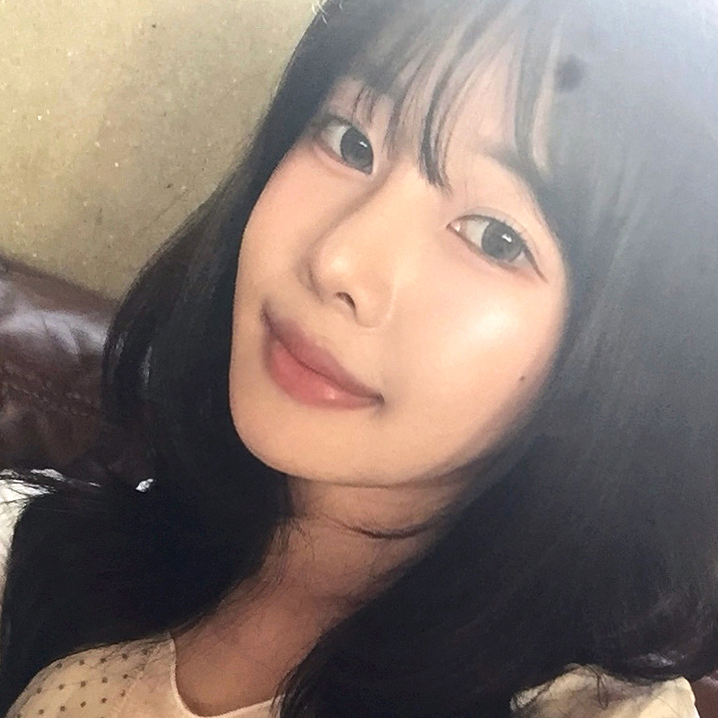 팝성형외과에서 눈밑지방재배치 4개월차 후기입니다!