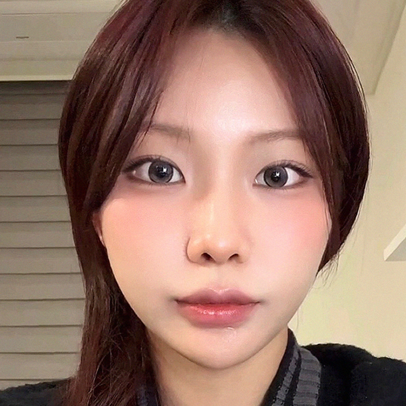 팝성형외과에서 12홀 자연유착+앞트임+윗트임+뒤밑트임 2개월차 후기입니다!