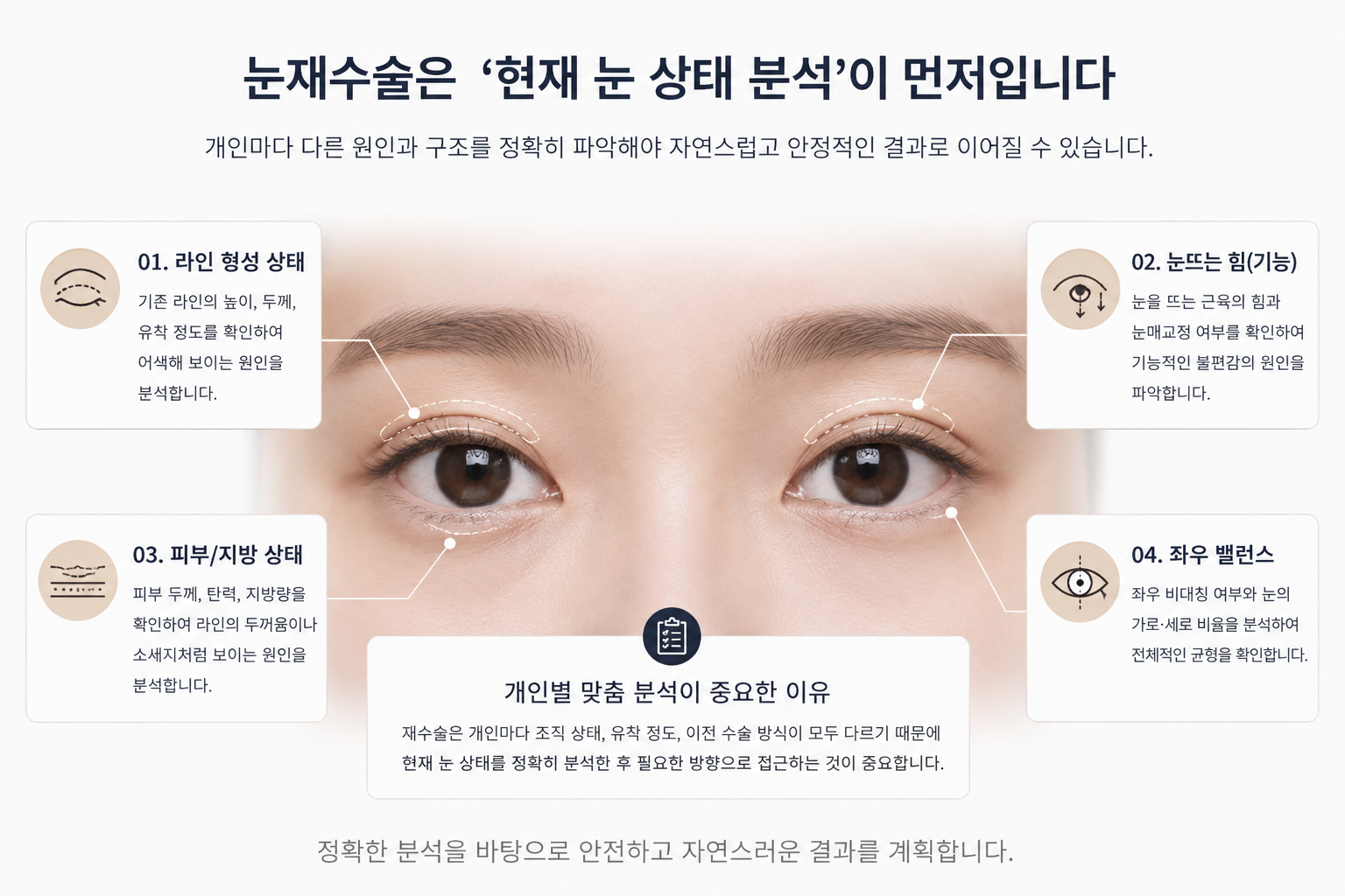 눈 재수술 케이스