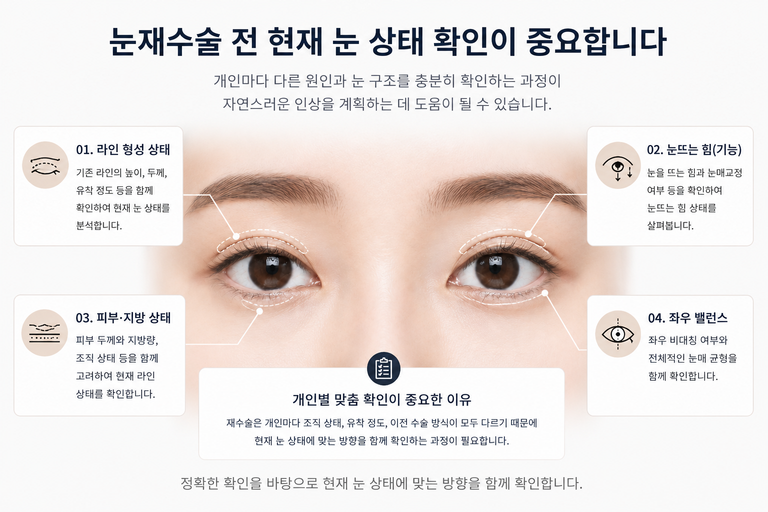 눈재수술, 너무 빨리 결정하면 안 되는 이유
