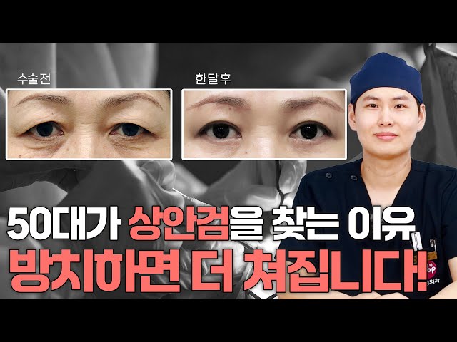 50대 눈꺼풀 처짐, 쌍꺼풀 수술이랑 다릅니다
