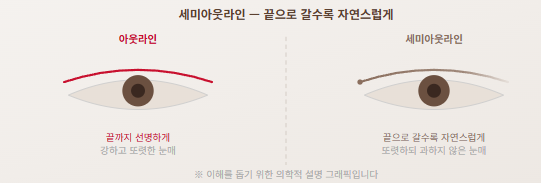[눈코 전담 센터] 세미아웃라인 쌍꺼풀, 자연스러우면서 또렷하고 싶다면 — 선택 전에 알아야 할 것들