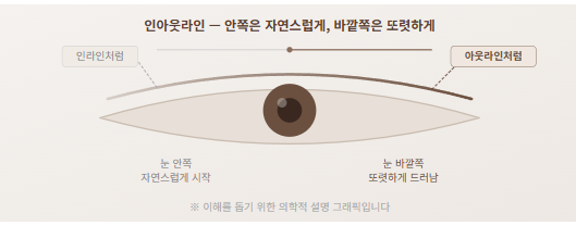 [눈코 전담 센터] 인아웃라인 쌍꺼풀이란 무엇인가요 — 가장 많이 묻는 질문들