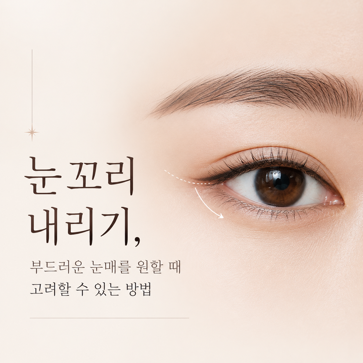눈꼬리 내리기, 부드러운 눈매를 원할 때 고려할 수 있는 방법