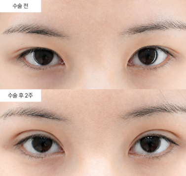 이마거상 효과가 없다는 게 사실인가요?