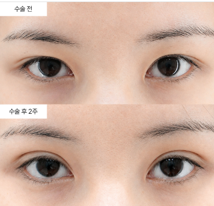 이마거상 비용, 실제로 얼마나 드는 걸까요?