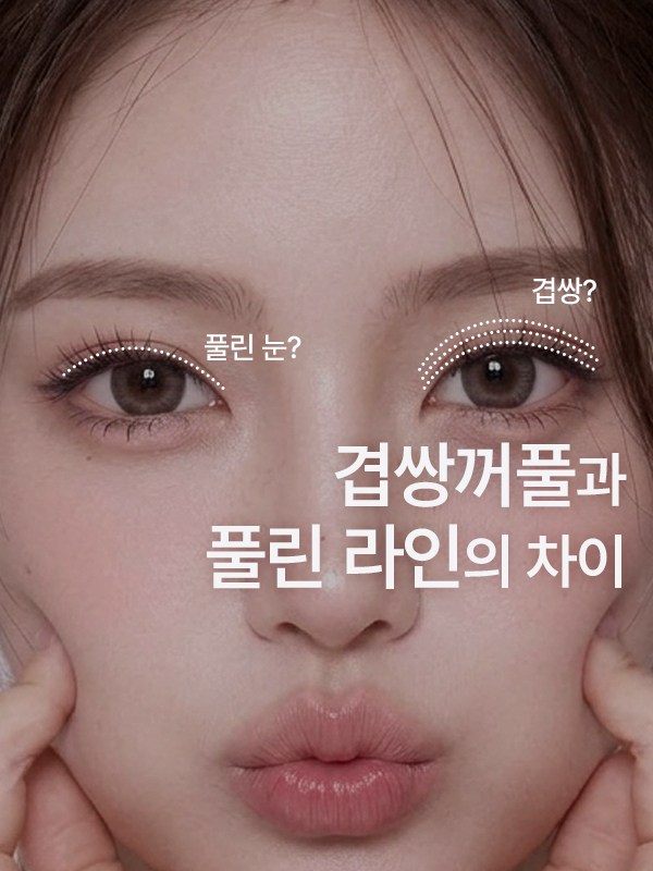 겹쌍꺼풀과 쌍꺼풀 풀림은 어떻게 다른가요?