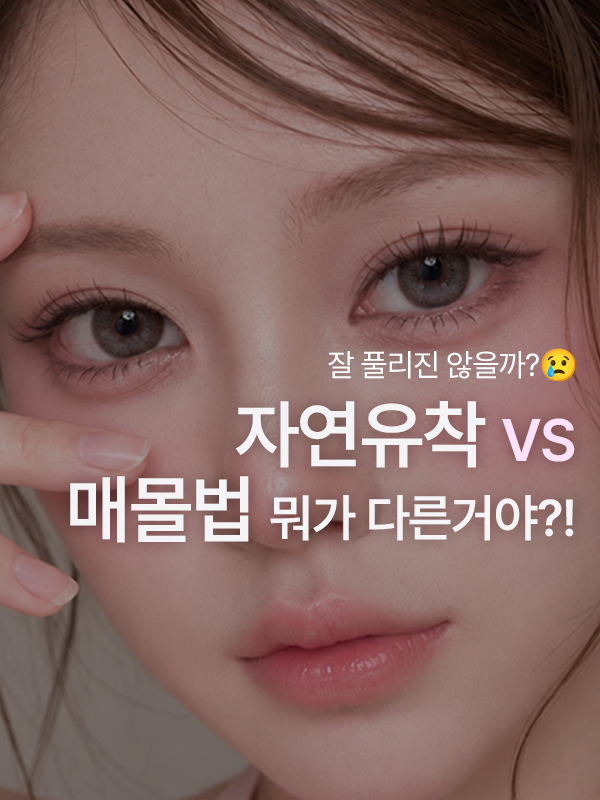 자연유착 쌍꺼풀, 매몰법이랑 뭐가 다른가요? 잘 풀리진 않을까요?