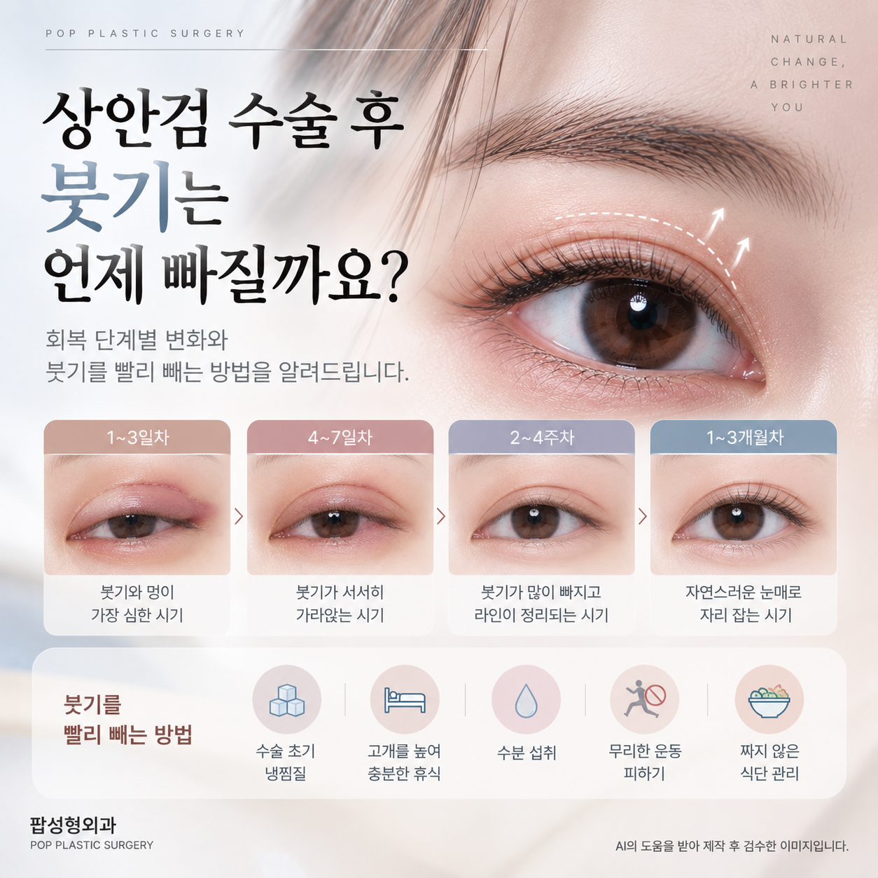 상안검 수술 후 붓기, 언제쯤 빠지나요?