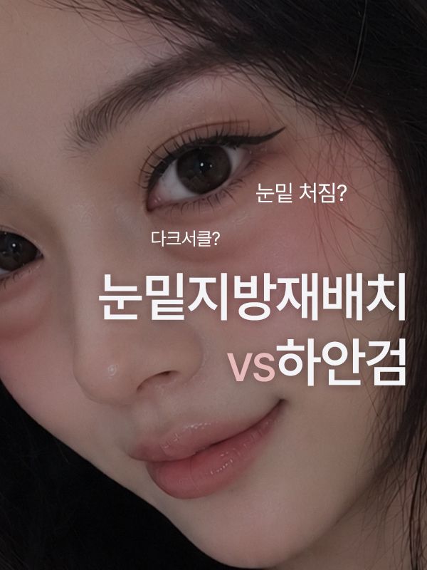 눈밑지방재배치와 하안검 수술, 어떤 차이가 있나요?