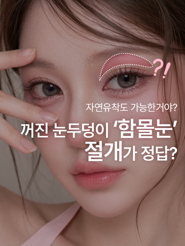 함몰눈은 무조건 절개해야 하나요? 자연유착으로도 개선할 수 있을까요?