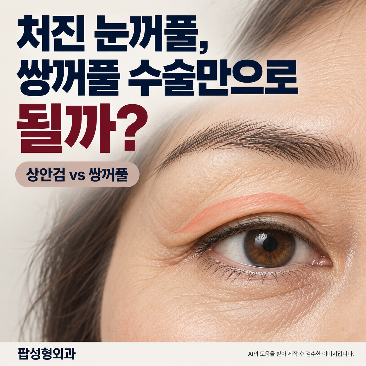 상안검 수술, 처진 눈꺼풀인데 쌍꺼풀 수술만으로 해결될까?