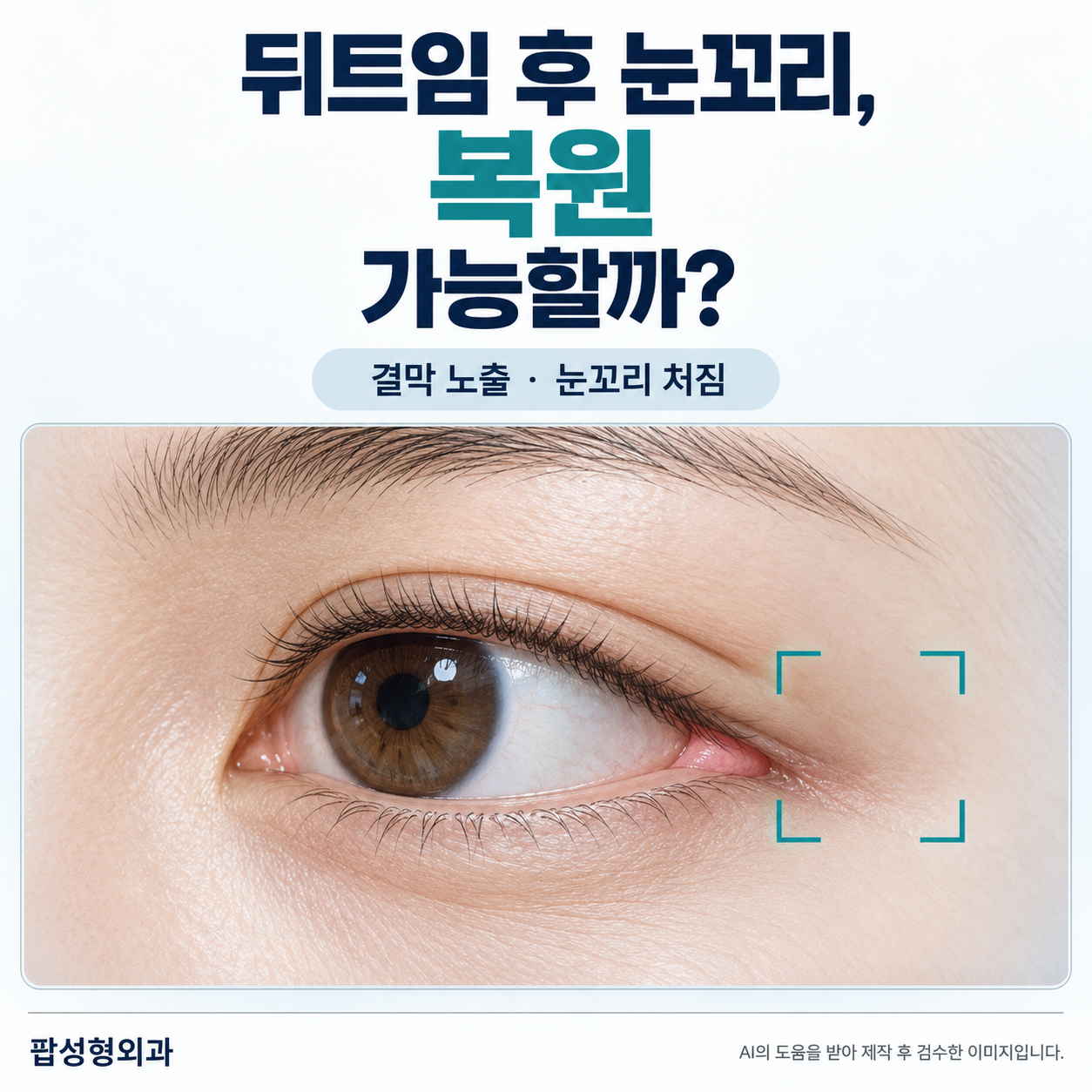 뒤트임 복원, 빨간 속살이 보이고 눈꼬리가 처졌다면 되돌릴 수 있을까?
