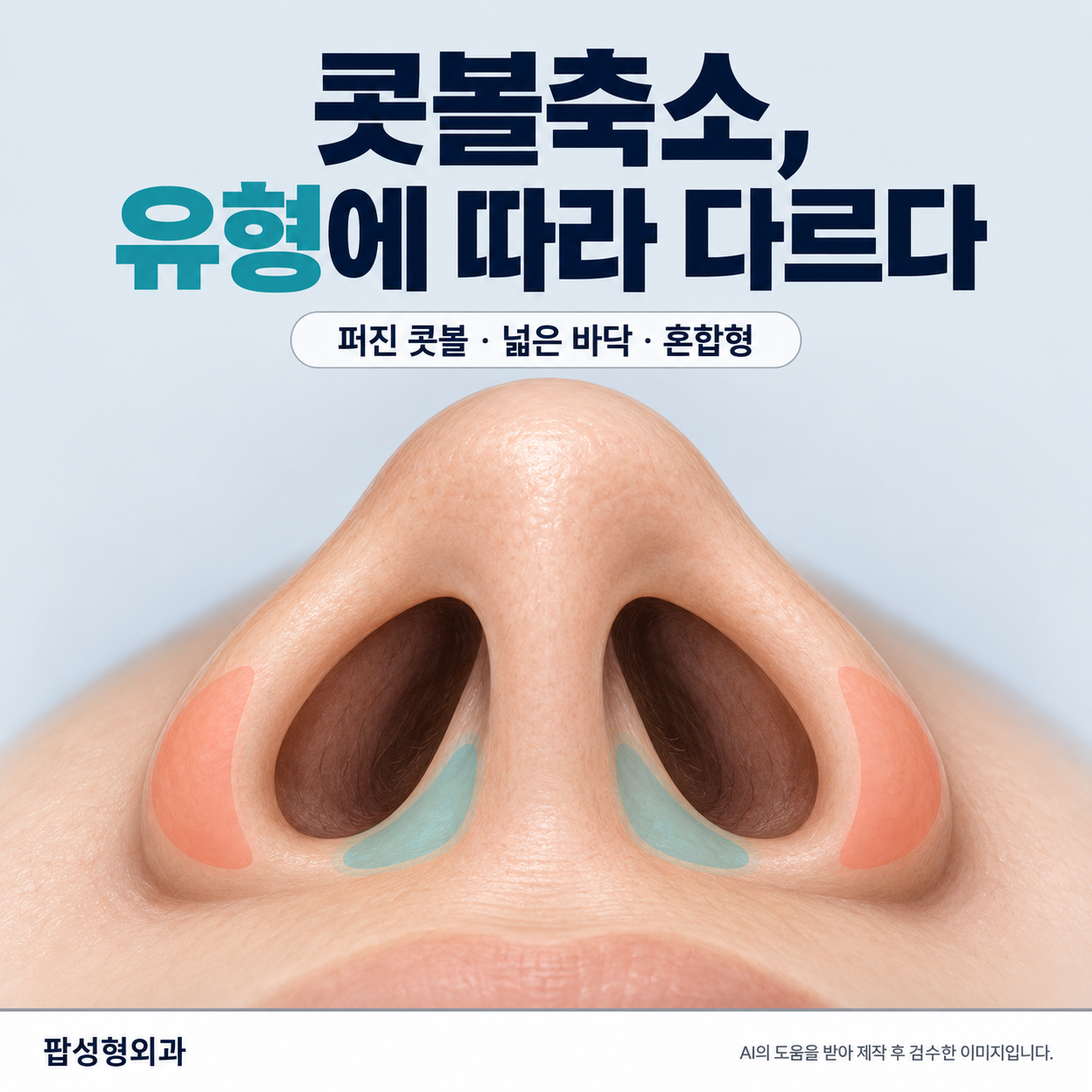 콧볼축소 방법 총정리: 콧볼 유형별 절개 위치와 자연스러운 범위