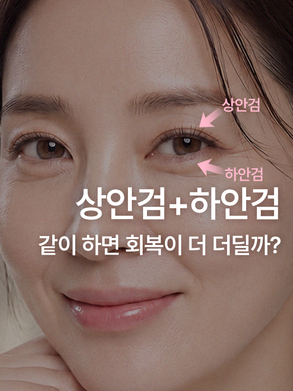 상안검 수술 회복기간, 하안검을 함께 하면 더 길어지나요?