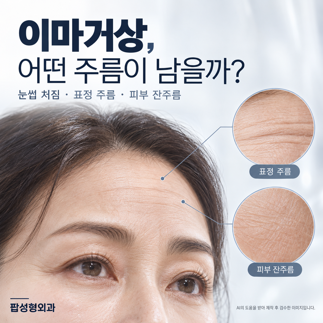 이마주름 수술, 이마거상으로 펴지는 주름과 안 펴지는 주름
