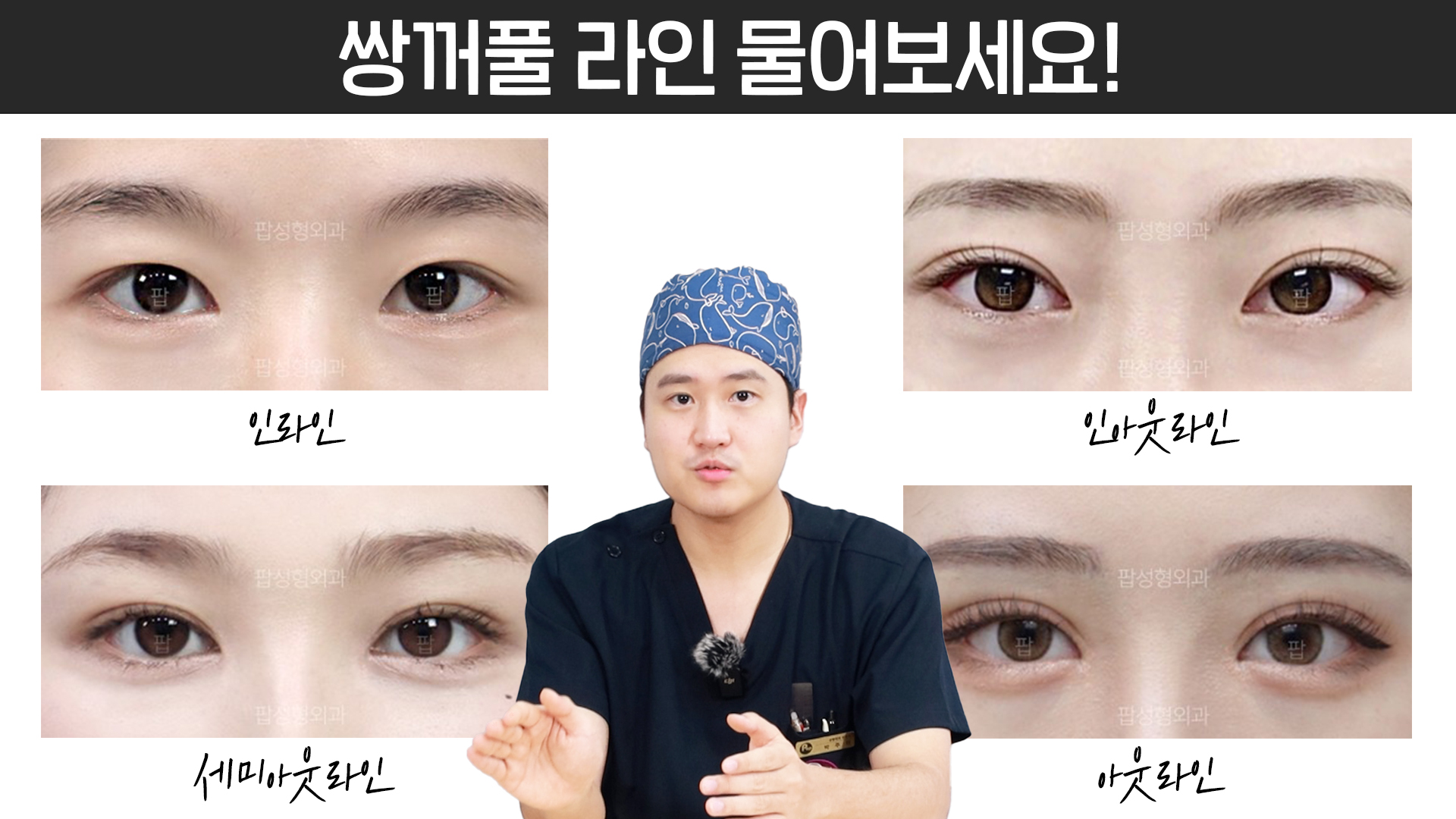 남자 쌍꺼풀 수술