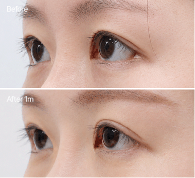 부자연스러운 라인 개선