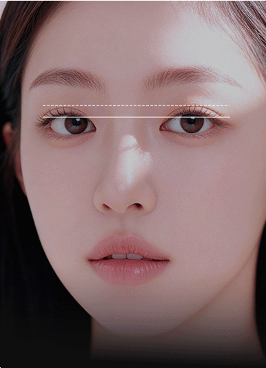 정도를 달리하여 비대칭 교정